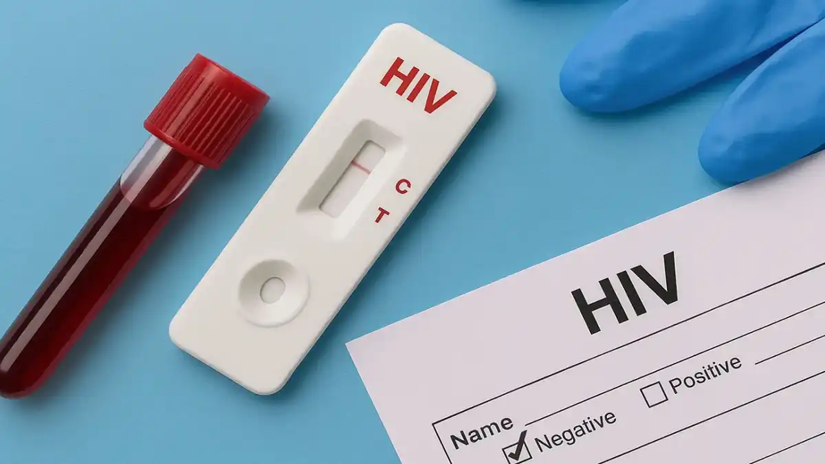 HIV Test : ಯುವ ಜನತೆಗೆ ಎಚ್ಐವಿ ಅಪಾಯ : ಎಲ್ಲಾ ಕಾಲೇಜುಗಳಲ್ಲಿ ತಪಾಸಣೆ ಕಡ್ಡಾಯ