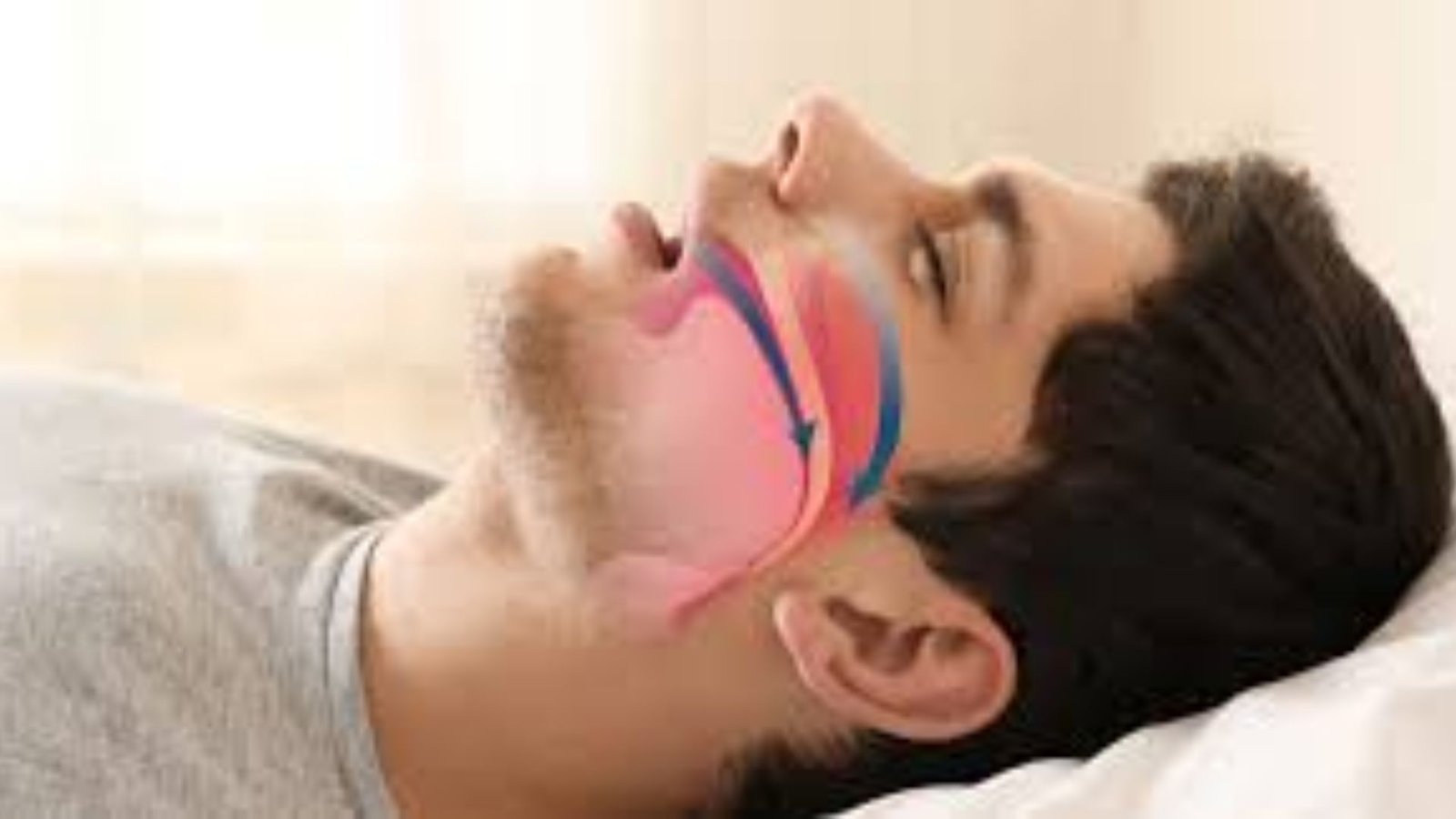 Mouth Breathing Health Issues